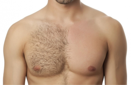 depilação masculina